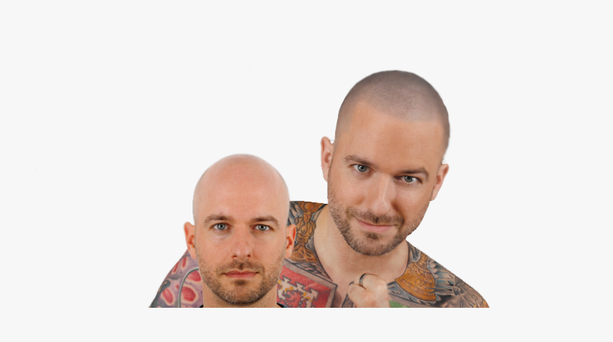 Hair Loss , Png Download - Gentleman, Transparent Png