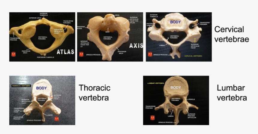 Types Of Vertebrae Anatomy, HD Png Download