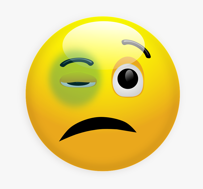 Black Eye Clip Art, HD Png Download