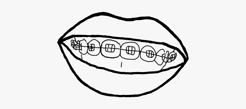 #brackets #sonrisa #dibujo #blancoynegro - Sketch, HD Png Download