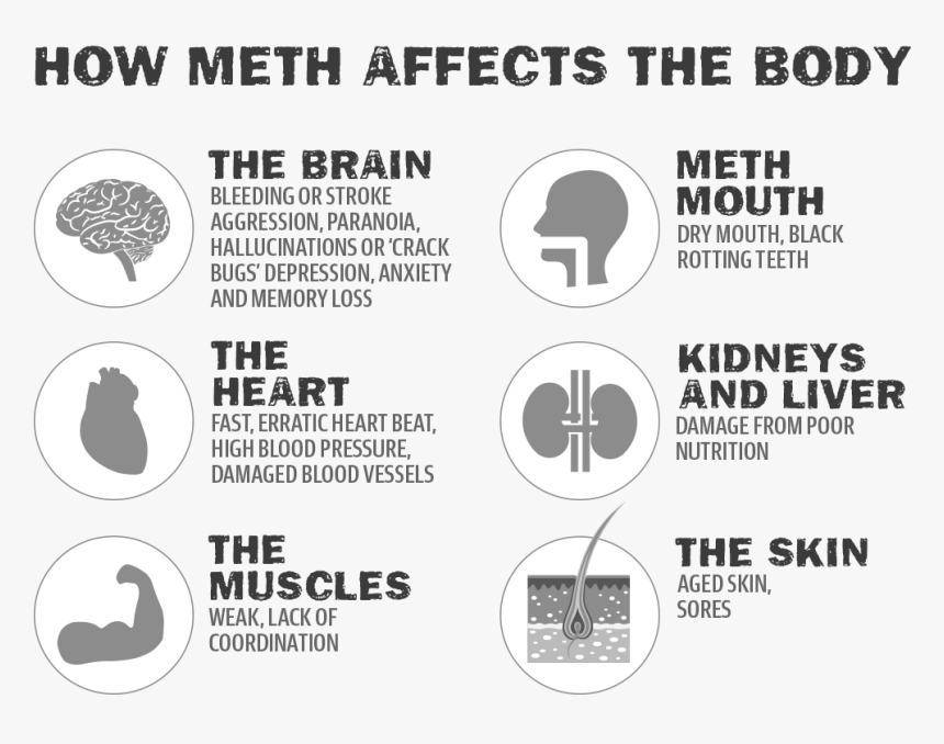 Ice Effects On Brain, HD Png Download