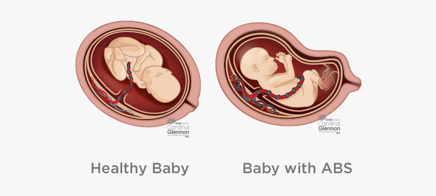 Children’s Healthcare Of Atlanta, HD Png Download