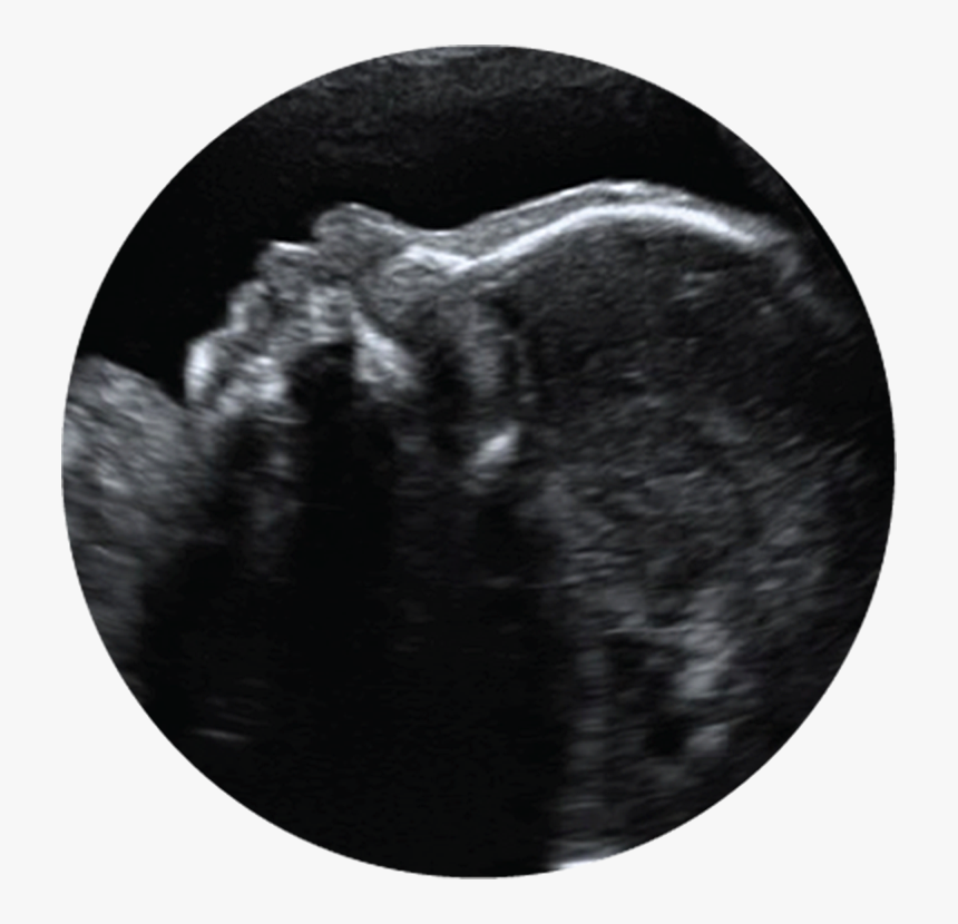 Prenatal Ultrasound Clipart, HD Png Download