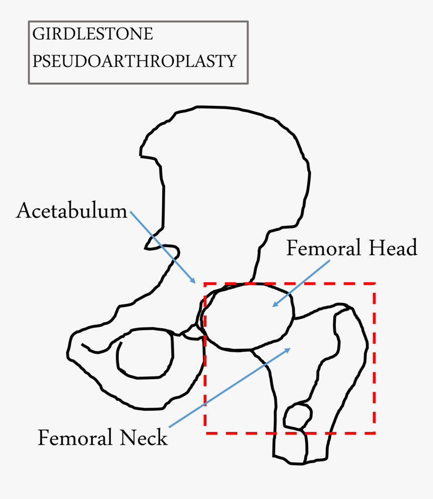 Diagram, HD Png Download