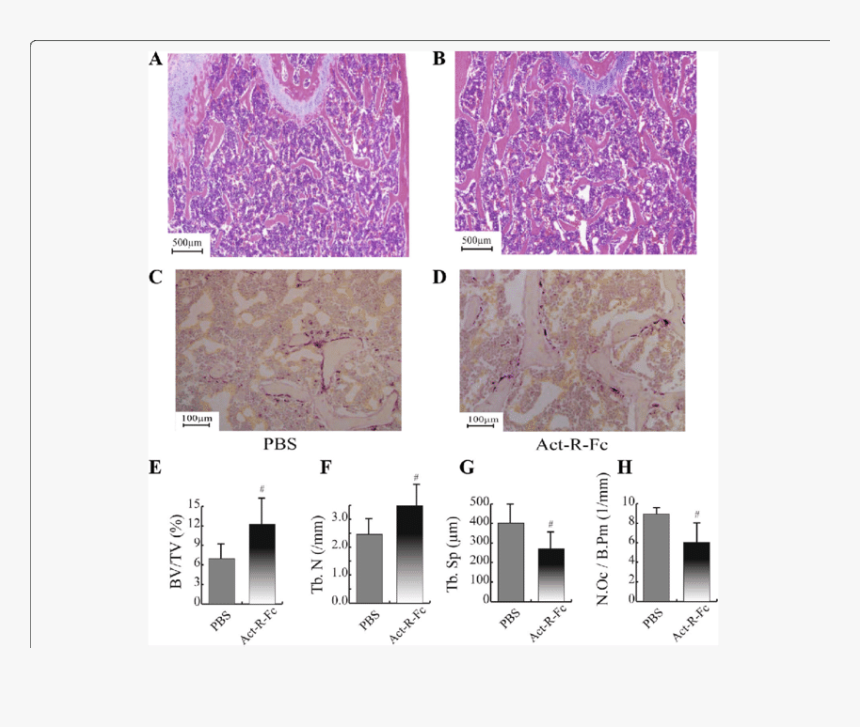 Histological Images Of The Distal Femur Showing An - Opg Femur Staining, HD Png Download