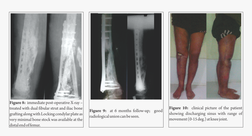 Radiography, HD Png Download