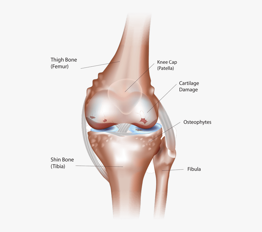 Knee Arthritis - Simple Knee Joints Diagram, HD Png Download