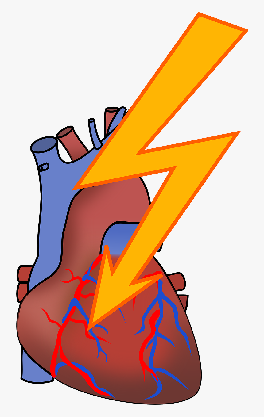 Heart Attack Reason In Urdu, HD Png Download