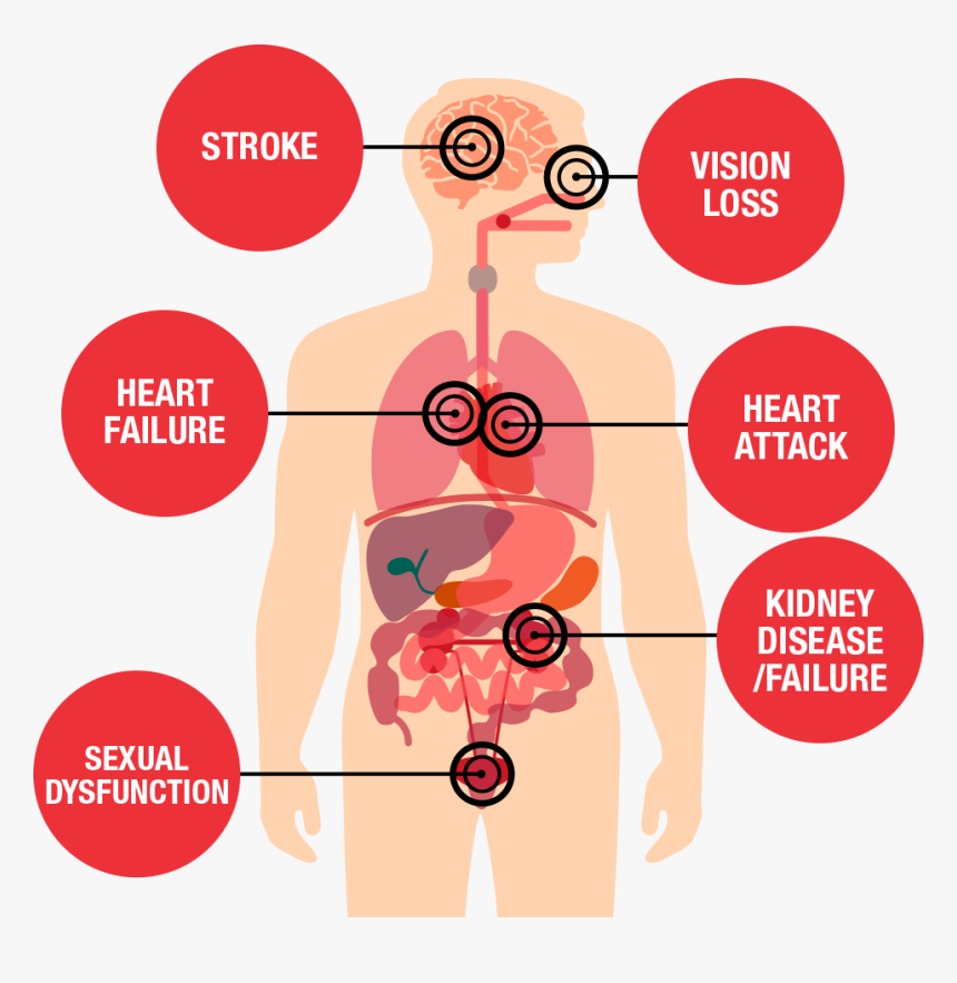 Health Threats Diagram - Effects Of High Blood Pressure, HD Png Download