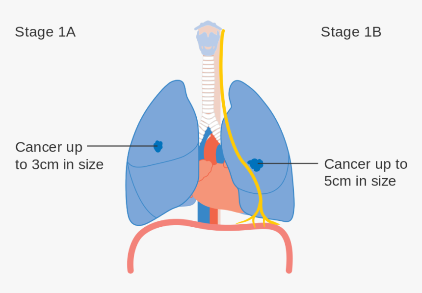 Cough Clipart Lung Cancer, HD Png Download