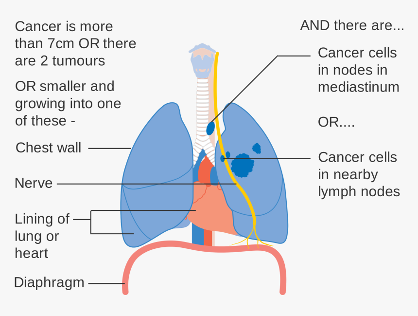 Clip Art Pictures Of Lung Cancer, HD Png Download