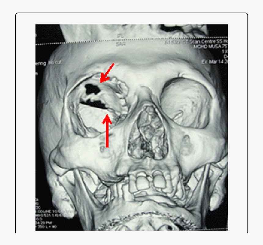 Red Right Arrow Png, Transparent Png