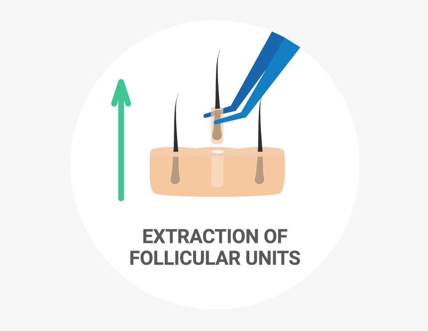 Eyebrow Transplant, HD Png Download