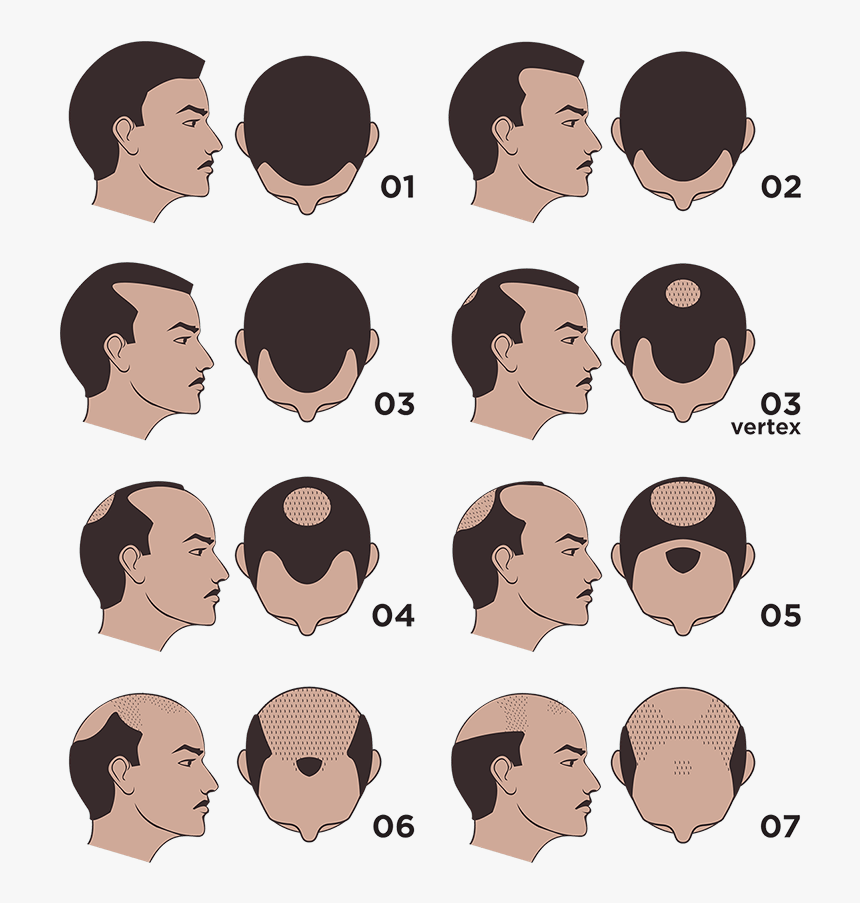 The Norwood Scale, HD Png Download