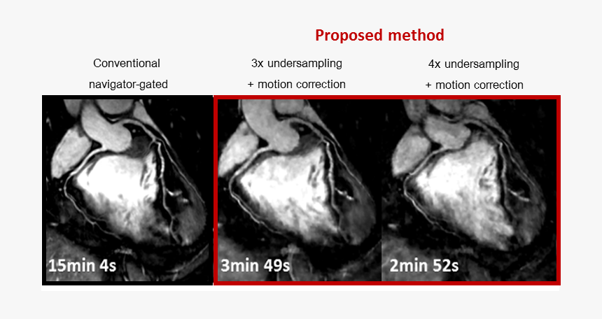 Fig1 Teresa, HD Png Download