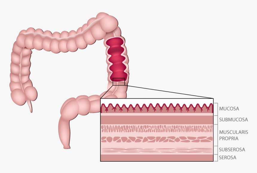 Anatomy Of The Colon, HD Png Download