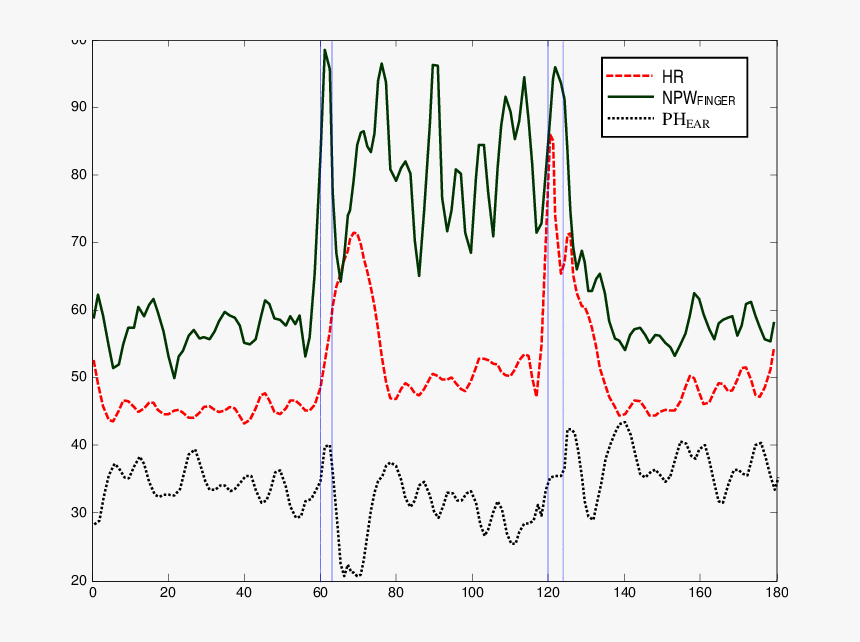 Heart Pulse Png, Transparent Png