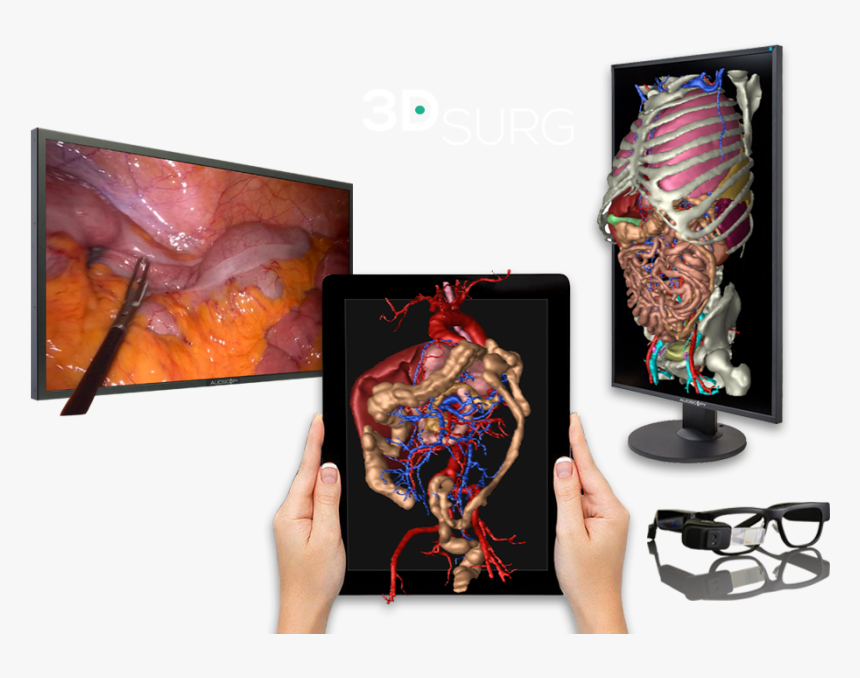 3d Technology Applied To Surgery - Graphic Design, HD Png Download
