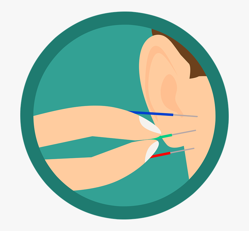 Acupuncture, Ear, Needles, Needle, Treatment - Listen To Advice Clipart, HD Png Download