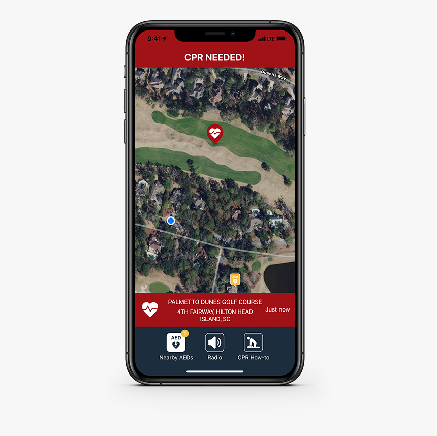 Pulse Point Wires Down, HD Png Download