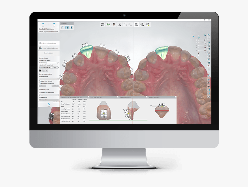 3shape Scanner Patient Monitoring, HD Png Download