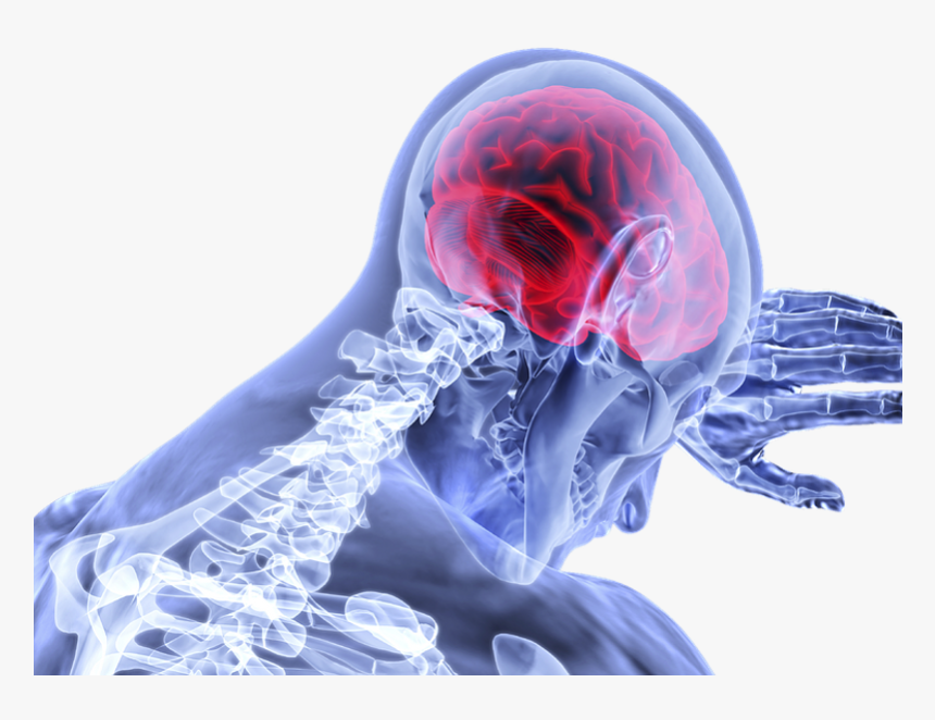 Brain Stroke Png, Transparent Png