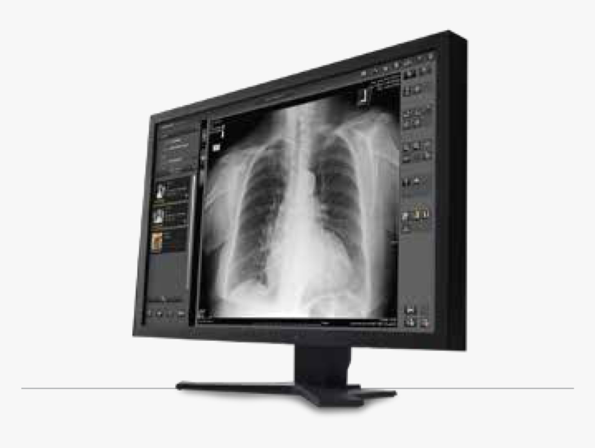 Carestream Image Suite, HD Png Download