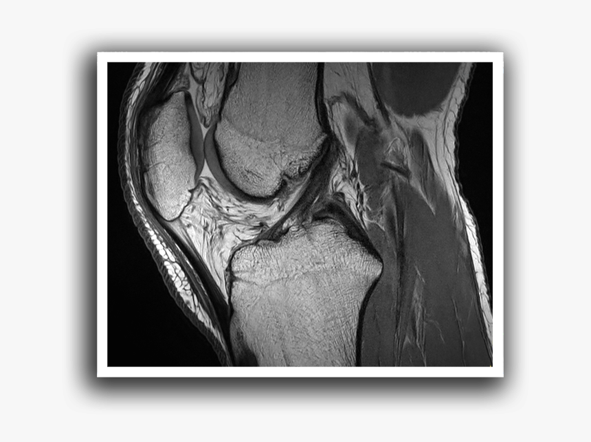 Bone, HD Png Download