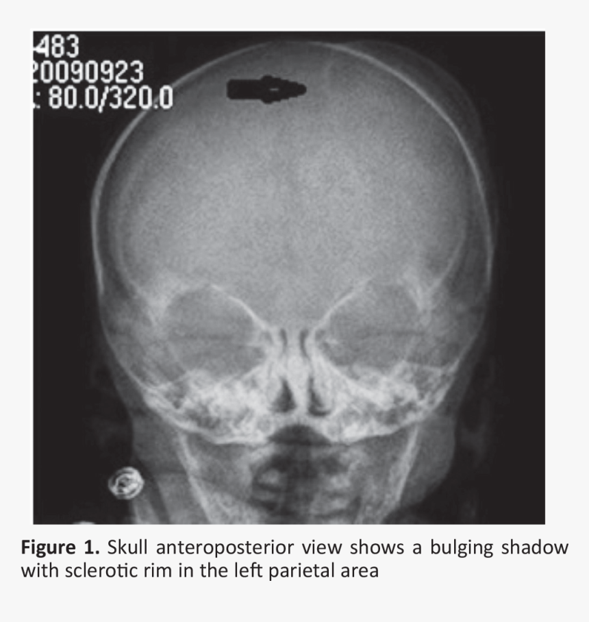 Clip Art Meandros Medical And Dental - Radiography, HD Png Download