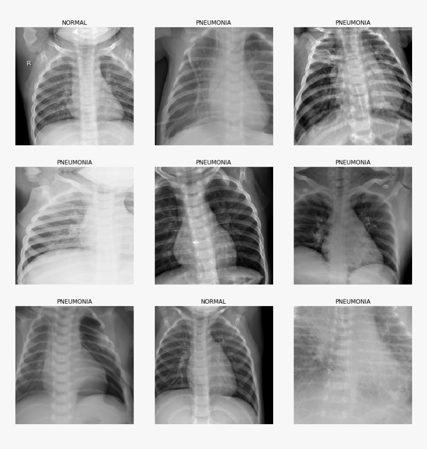 Medical Radiography, HD Png Download