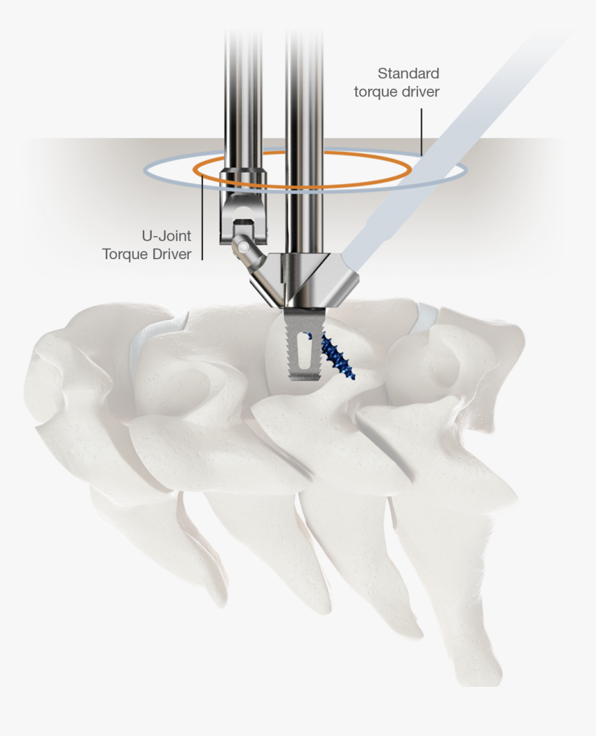 U-joint Torque Driver - Stand Alone Cervical Driver, HD Png Download