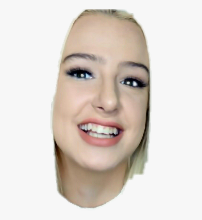 Sticker Chloe Sommersby Png Tana Mongeau Teeth - Tanas Teeth Before And After, Transparent Png