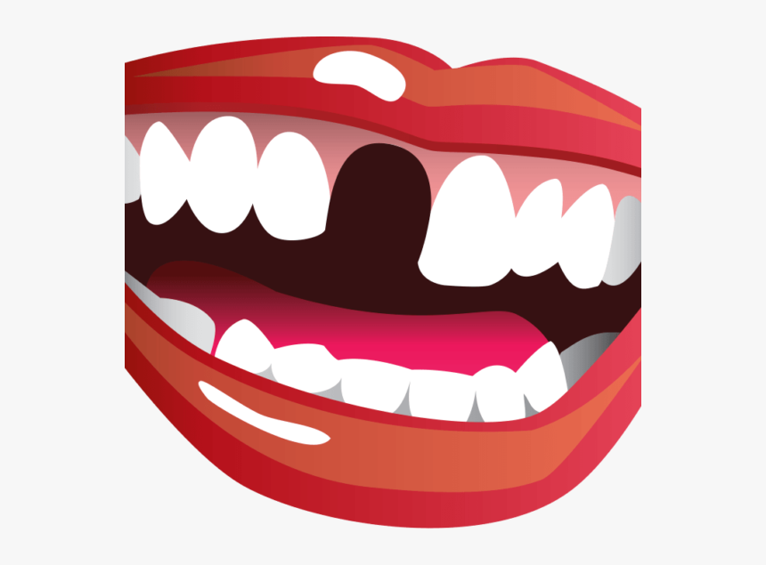 Transparent Brush Teeth Clipart - Missing Teeth Clipart, HD Png Download