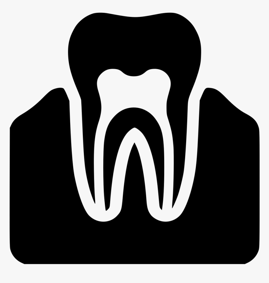 Gum Nerves, HD Png Download