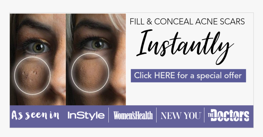 Contact Lens, HD Png Download