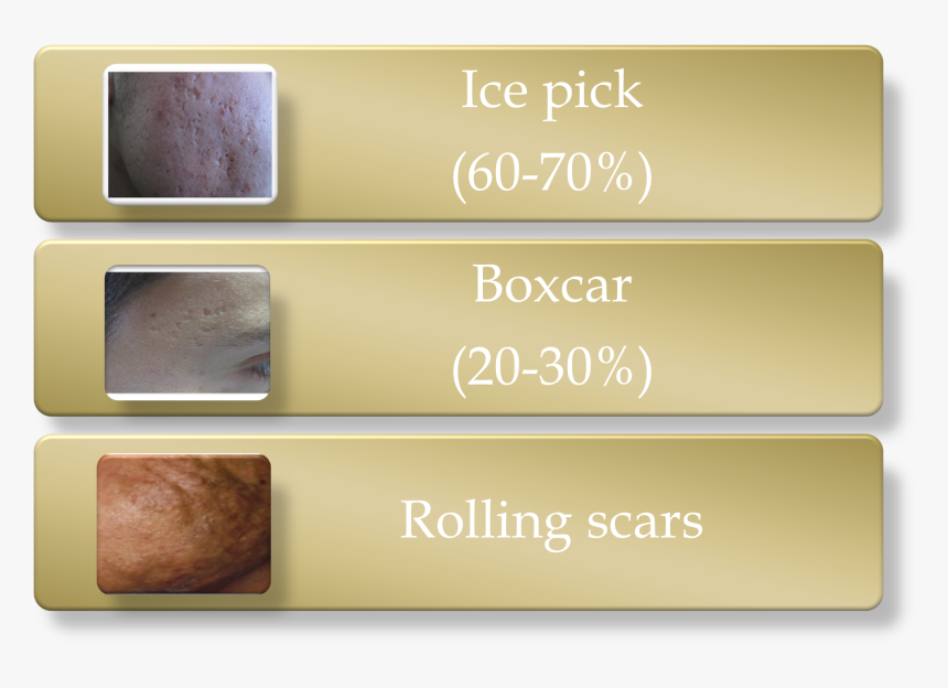 Transparent Ice Pick Png - Ice Pick Hole, Png Download