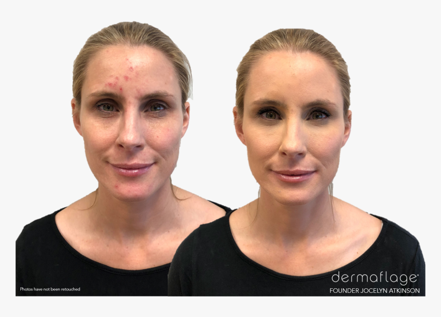 Dermaflage Concealer, HD Png Download