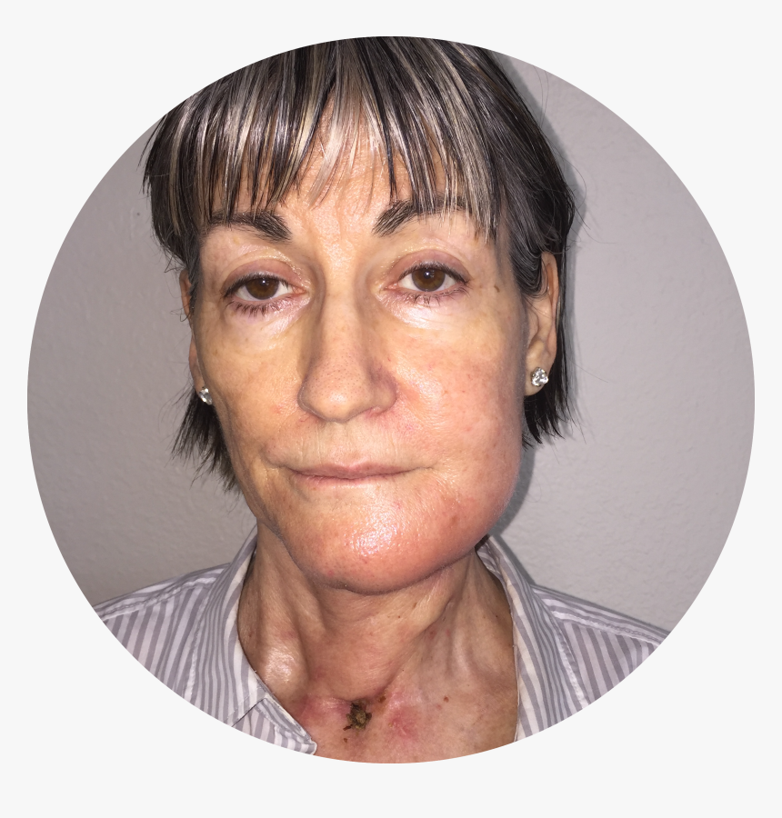 Close-up, HD Png Download