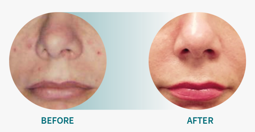 Lip Gloss, HD Png Download