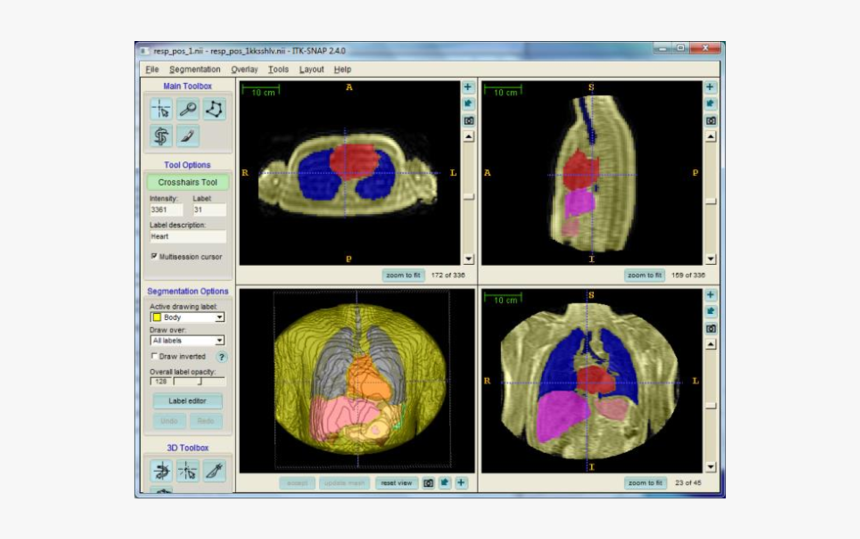 Computed Tomography, HD Png Download