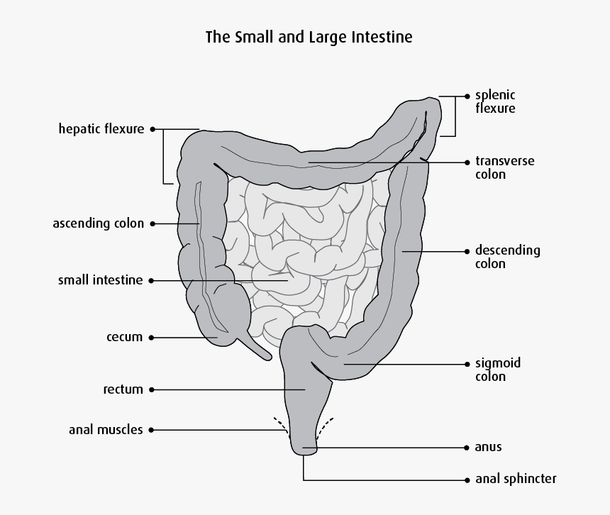 Segmental Resection Of Small Bowel , Png Download - Small Bowel Segmental Resection, Transparent Png