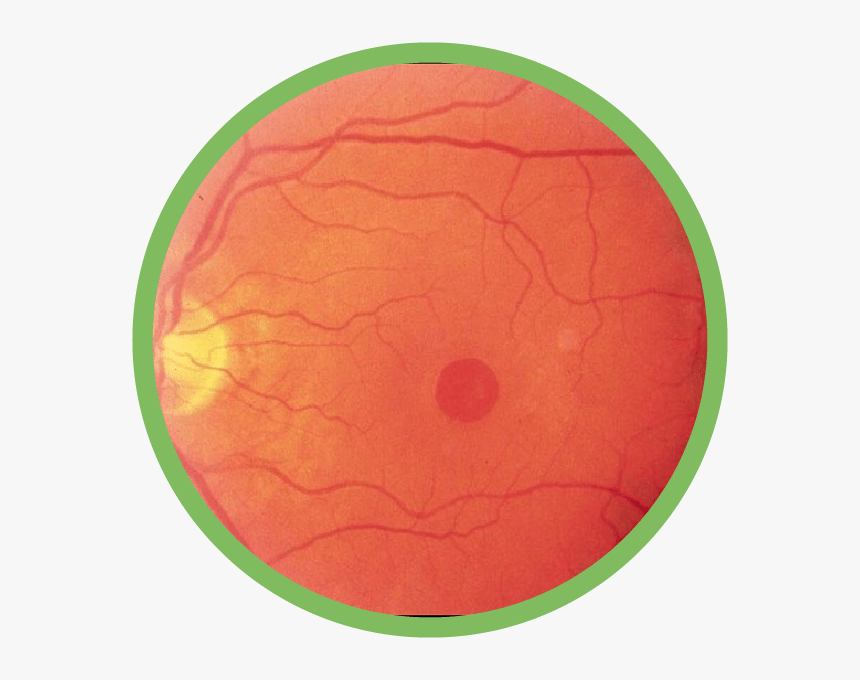 Macular Hole - 狂犬病 予防 接種 シール, HD Png Download