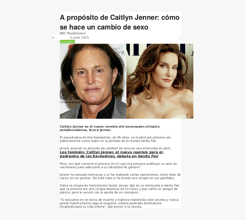 Operación Cambio De Sexo, HD Png Download