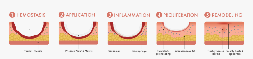Renovoderm Phoenix The Healing Process - Pattern, HD Png Download