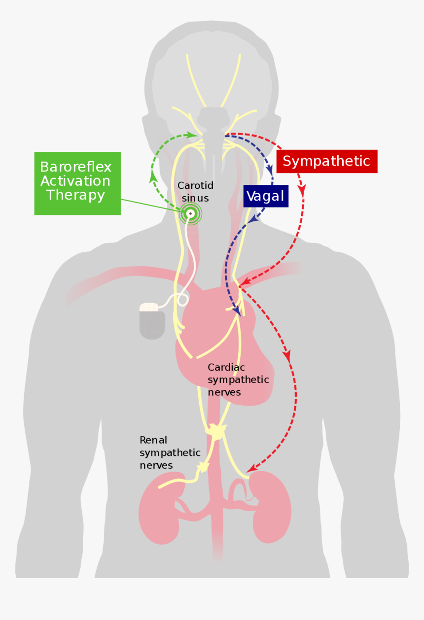 Carotid Baroreceptor, HD Png Download