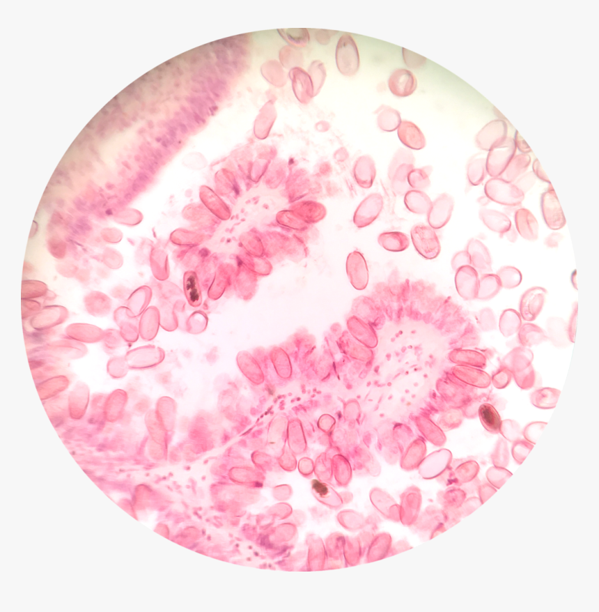 Avian Coccidiosis, HD Png Download