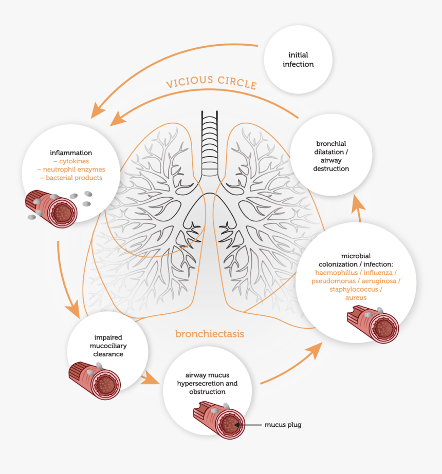 Physiology - Vicious Cycle - Vicious Cycle Of Bronchiectasis, HD Png Download