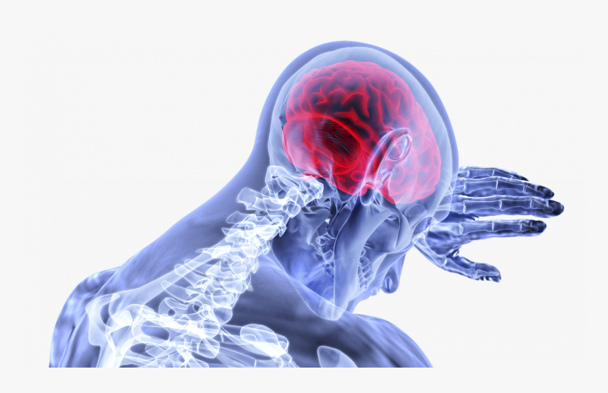 Concussion Brain Png, Transparent Png