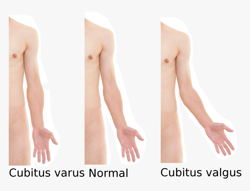 Cure Carrying Angle Of Elbow, HD Png Download