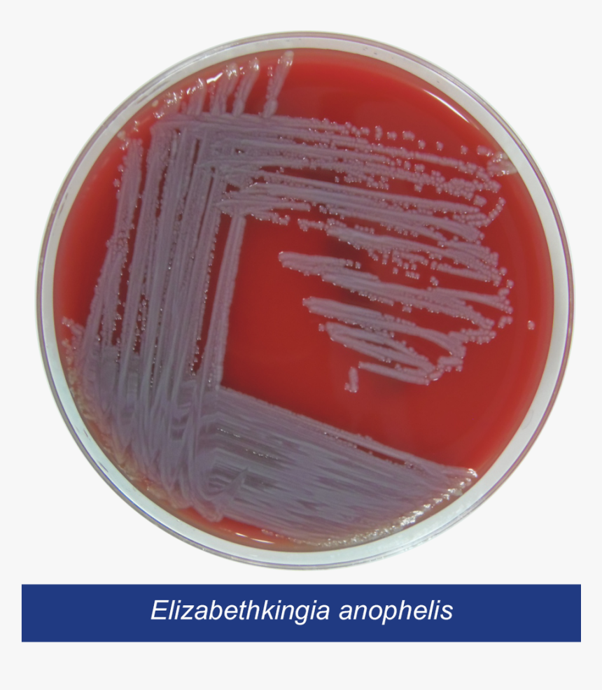 Petri Dish Png, Transparent Png